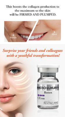 表面のためのBOTOXの血清のMicroneedlingの血清のMesotherapyのMESO血清を白くすること
