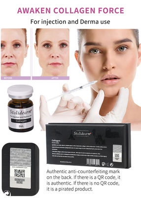 皮膚を明るくする抗老化コラーゲン皮膚充填剤 5ml*5ビオル スタリダームブランド