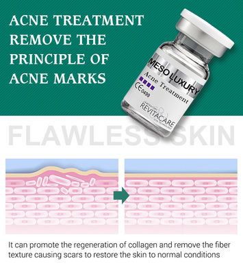アクネの傷のための処置Mesotherapyを白くする純粋な植物の丘疹の明確な血清