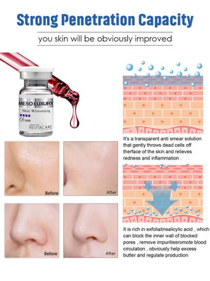 贅沢なMeso血清Microneedlingは直ちに本質10MLを白くする皮を吸収した