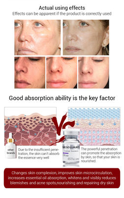 緩和Meso血清のMicroneedling Mesotheraphyのキャビアの本質の血清を固める