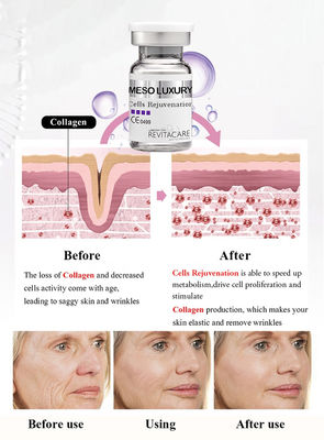 Meso細胞皮の白くなることのための活性化力の血清の反老化Microneedling