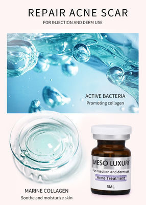 贅沢な青年血清の注入のMesotherapyの赤い点はアクネの注入の処置の皮を剥ぐ