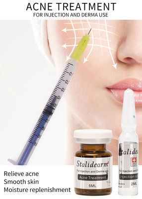 副作用を養わないStalidearmのアクネの処置の注入の血清Mesotherapy
