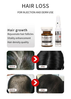 注入可能なヘアエクソソームセラム フランスオリジナル Stalidearm ヘアグロースメソセラピーソリューション