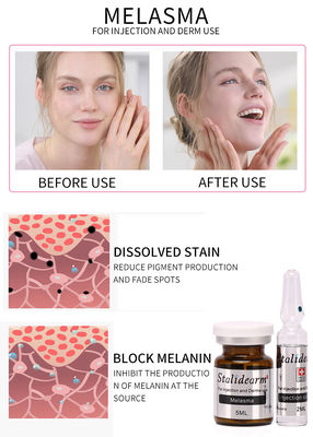 Melasmaの注入の使用血清の金庫およびよい効果のMesotherapy 5ml/bottleの血清セット