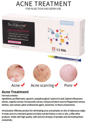 アクネの処置の本質の血清の注入は安全でよい効果の血清が5pcs/Setを置いたMeso Theraphyを使用する